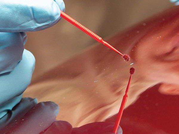 как убрать сколы на капоте своими руками